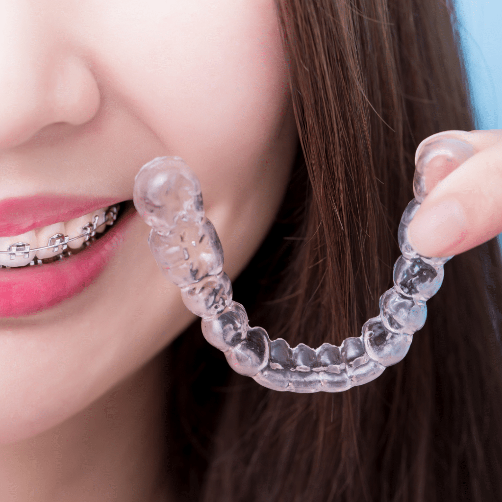 Girl with braces holding clear dental aligner.